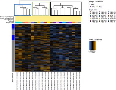 Distinct Gene Expression Profiles in Viable Hepatocellular Carcinoma Treated With Liver-Directed Therapy